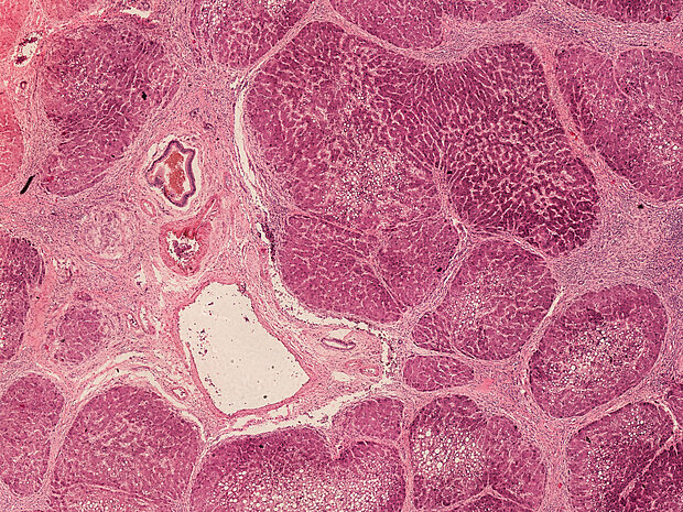 Mikroskopaufnahme vom Gewebe der menschlichen Leber