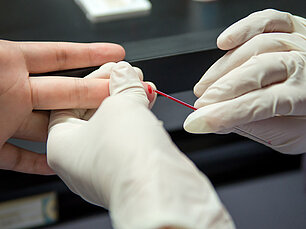 Der Hepatitis C-Schnelltest ist ein Antikörper-Suchtest. Benötigt wird dafür nur eine kleine Menge Blut, die aus der Fingerkuppe entnommen wird. 
